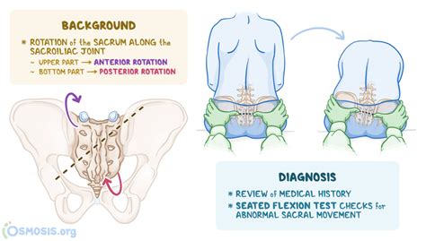 sacral torsion test|what causes sacral torsion.